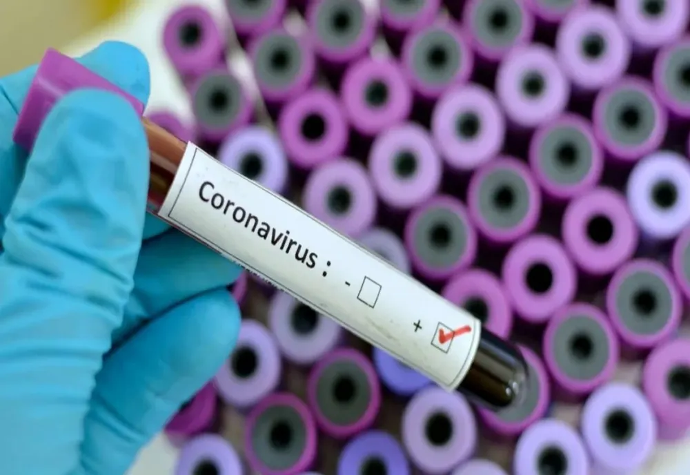 637 de cazuri noi de infectare cu coronavirus, în România! Aproape 10% dintre bolnavi, în judeţul Braşov!