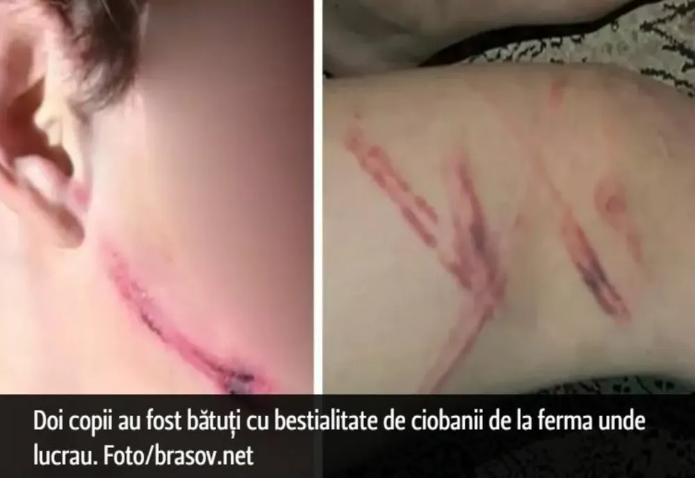 Caz șocant în județul Brașov. Doi copii au fost bătuți de ciobanii beți de la o fermă