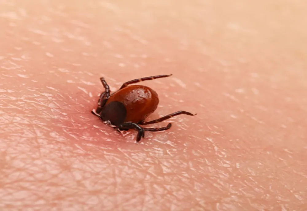 Începe sezonul căpușelor! Cum să ne păzim de nesuferitele insecte și ce să facem în cazul în care ne-a mușcat una