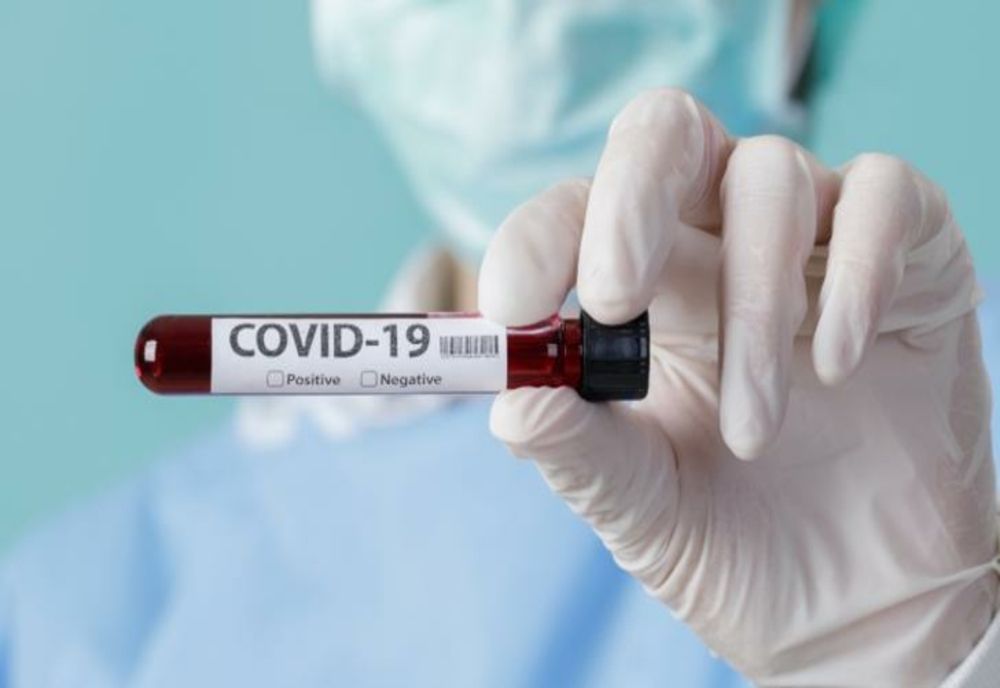 Bilanț COVID pentru ultimele 24 de ore:  808 cazuri noi și 23 de decese/ 464 dintre infectați se află pe secțiile ATI