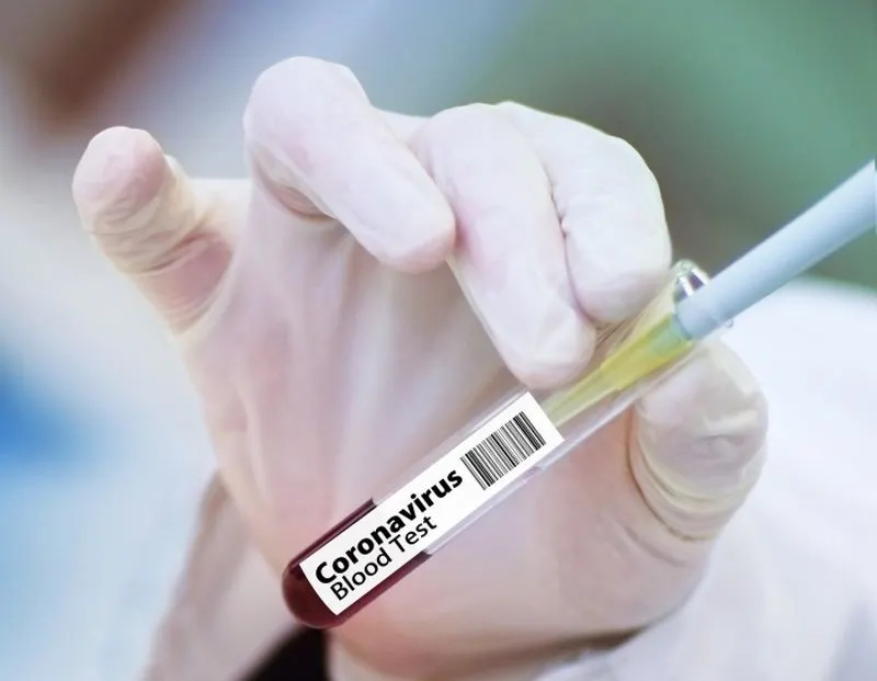 test coronavirus