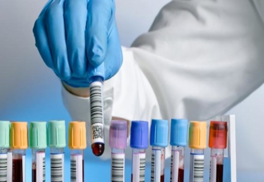 Legătura dintre tutun și coronavirus! Un producător de țigarete ar putea salva planeta!