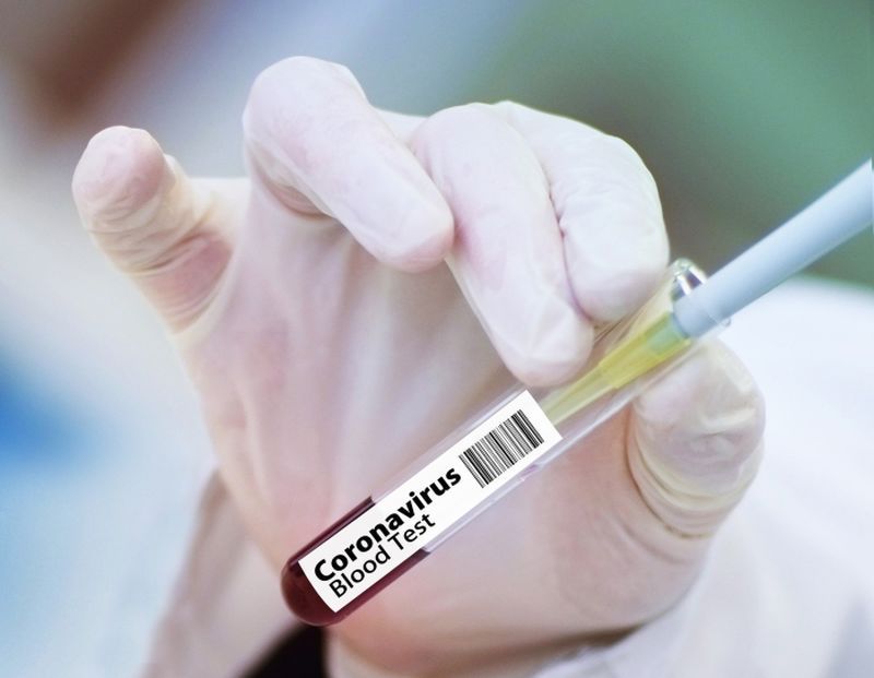 test coronavirus