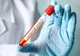 Bilanț coronavirus 22 decembrie: 851 cazuri noi și 62 decese dintre care 18 anterioare