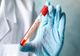 641 de cazuri noi de infectare cu coronavirus, în România!