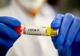 Bilanț coronavirus 30 decembrie: 1.497 cazuri noi și 37 de decese dintre care 1 anterior