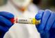 Bilanț coronavirus 18 februarie: 14.524 cazuri noi și 135 decese
